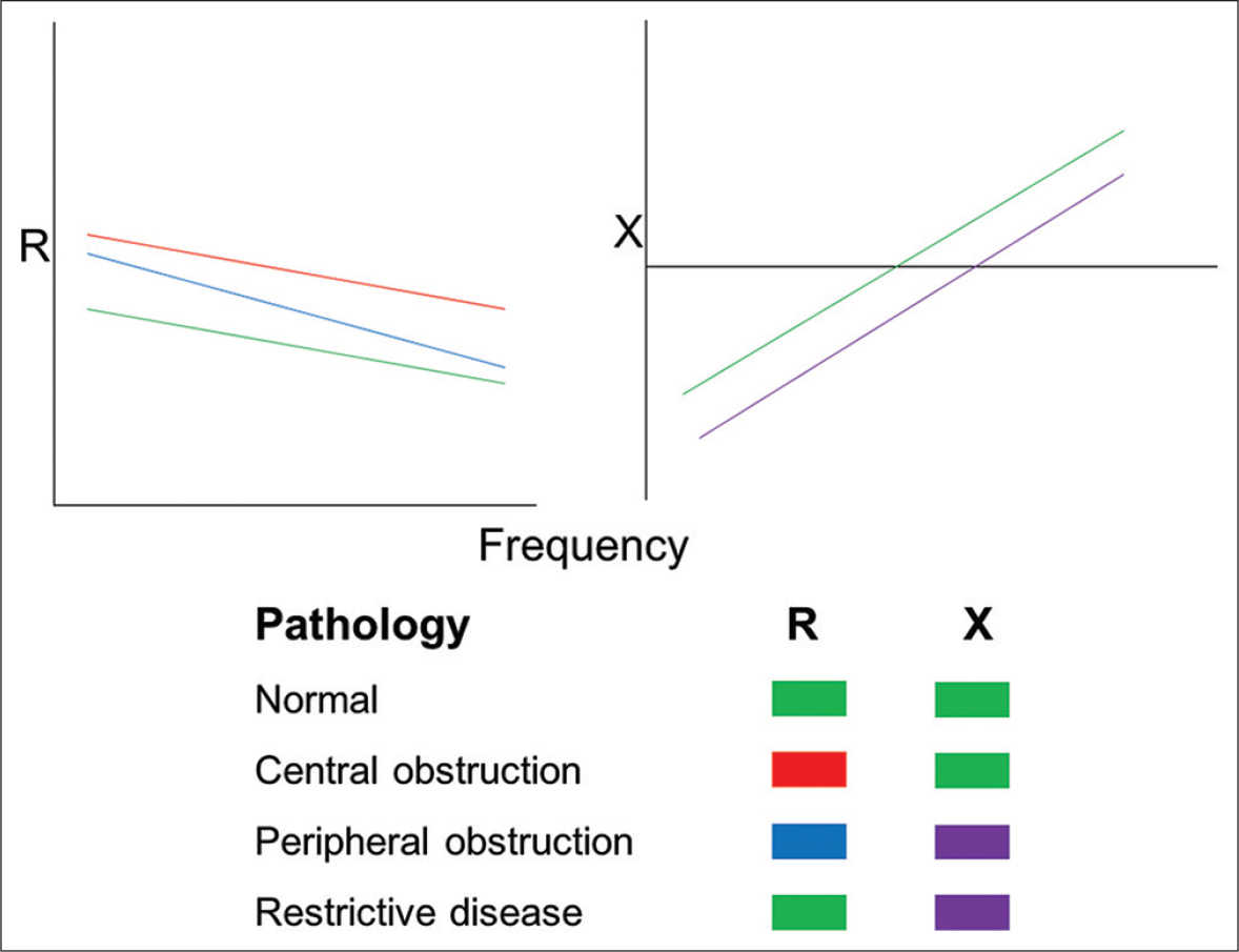 Respiratory characteristics in health and disease. R – Resistance (in cm H2O.L-1.s-1), X – Reactance (in cm H2O.L-1.s-1). During normal healthy conditions, the resistance and reactance are at baseline (green). Various combinations of changes in these parameters will help in determining the nature and location of pathology.