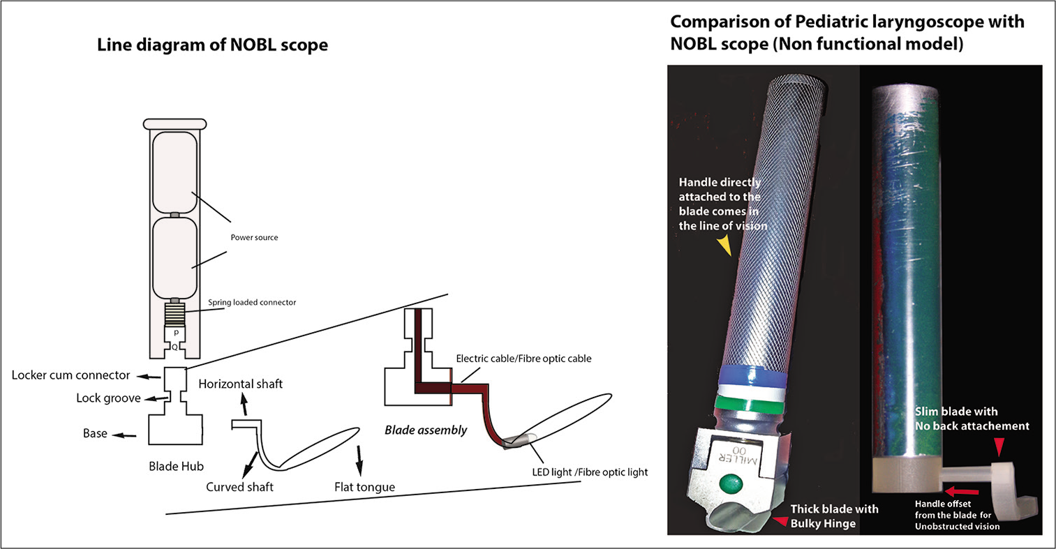 NOBL Scope – Illustration and comparison with conventional laryngoscope.