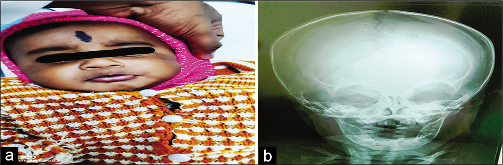 (a) Child picture after treatment. (b) Child X-ray after treatment.