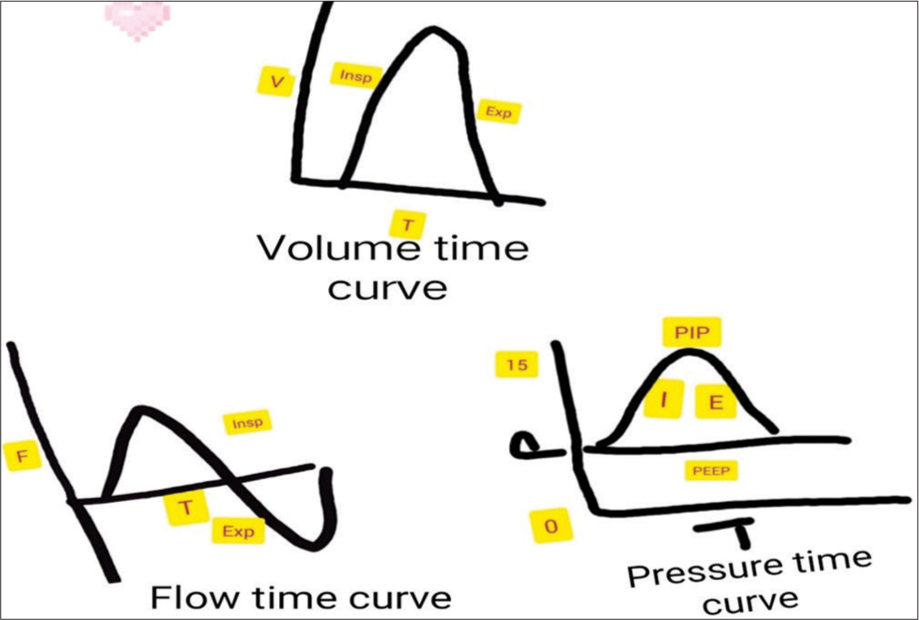 The scalar graphics demonstrate pressure, flow, and volume versus time curves. The flow time curve is biphasic, and the pressure time and volume time curves are monophasic. The pressure curve against the time shows peak end-expiratory pressure and peak inspiratory pressure (0-15), I (inspiration), E (expiration), the volume-time curve demonstrating inspiration and expiration, and the flow time curve demonstrating the inspiratory (above the baseline) and expiratory flow (below the baseline). V: Volume, T: Time, F: Flow, Insp: Inspiration, Exp: Expiration, PEEP: Peak endexpiratory pressure, PIP: Peak inspiratory pressure,