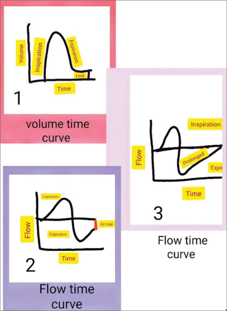 (1) Volume time curve demonstrating air leak (expiratory trace descends smoothly and then plateaus and does not reach the baseline), (2) flow time curve demonstrating prolonged expiration meaning increased expiratory resistance, (3) flow time curve demonstrating air trap where in the expiratory phase not reaching the baseline.