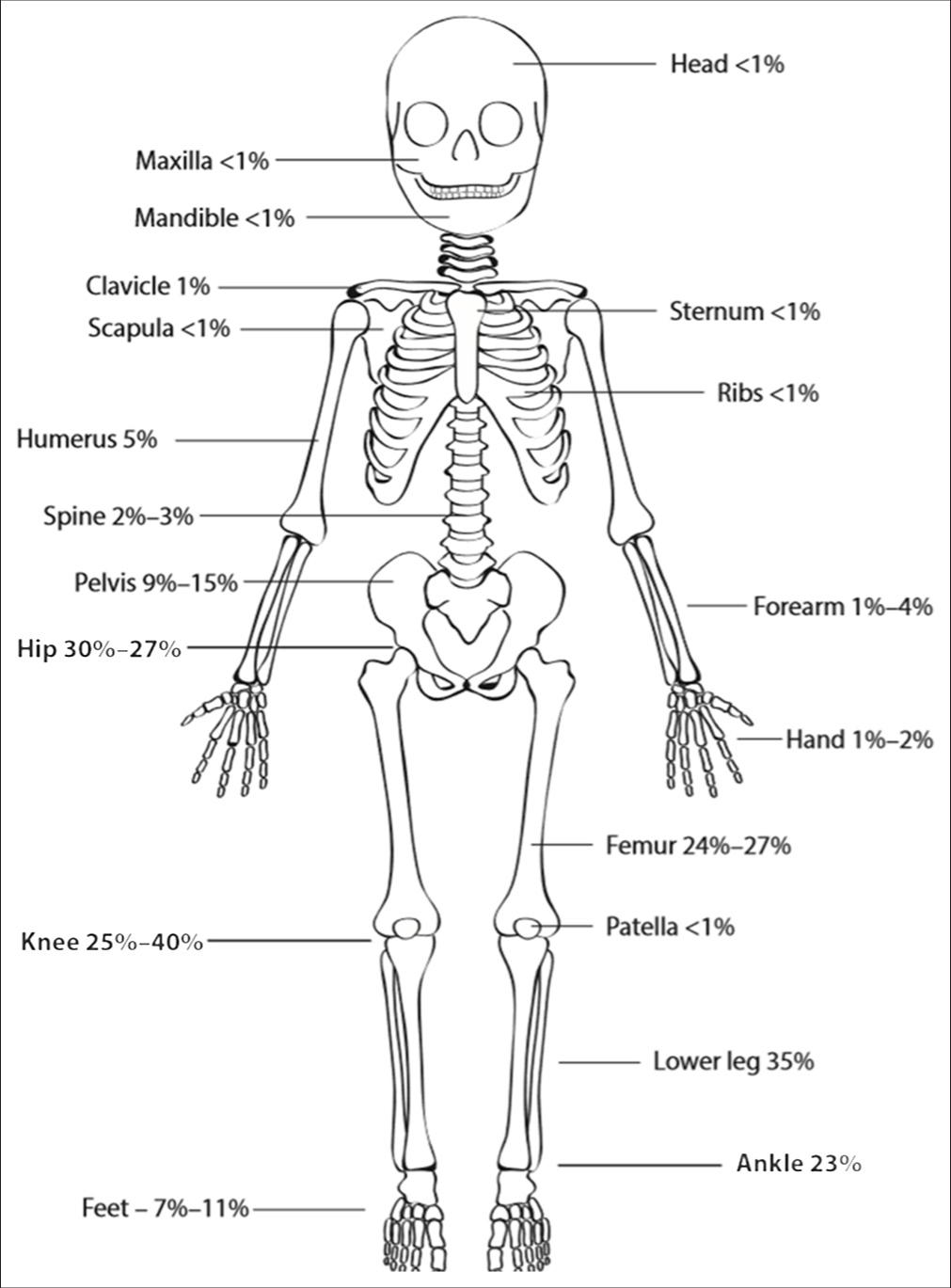 Anatomic distribution of osteoarticular infections.